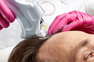 PRP Treatment in Ahmedabad, Best PRP Hair Loss Treatment In India