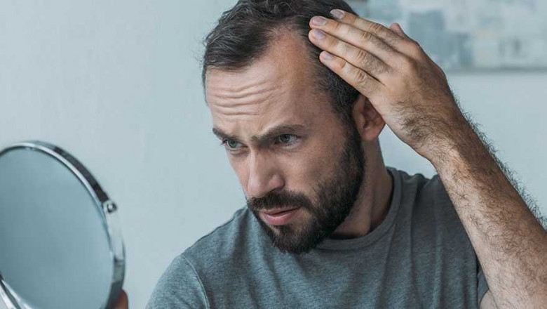 Tips To Find The Best Hair Transplant Clinic in Kolkata