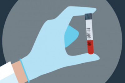 Cholesterol Screening Cholesterol Lab Testing Market: Analysis, Size, Share, Trends, and Forecast for 2022-2030