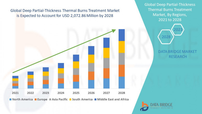 Deep partial-thickness thermal burns treatment market is segmented into fire burn injuries, scald burn, and hot objects.