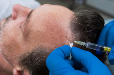Hair Fall Treatment at No-Cost EMI in Indore