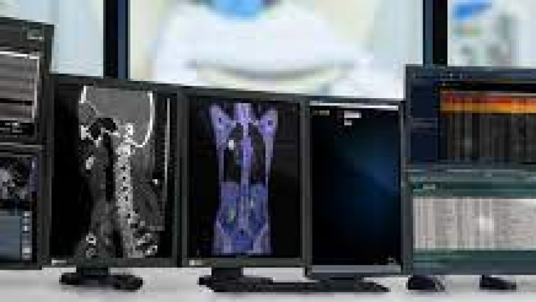 Report on Medical Imaging Workstation Market Research 2028 - Value Market Research