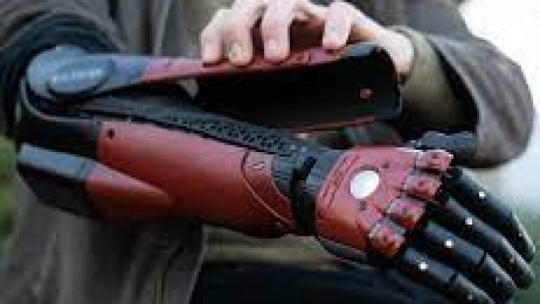 Report on Prosthetic Arm Market Research 2028 - Value Market Research