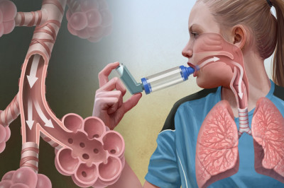 Adrenergic Receptor Agonists - Unani Powerful Medications For Asthma Treat?