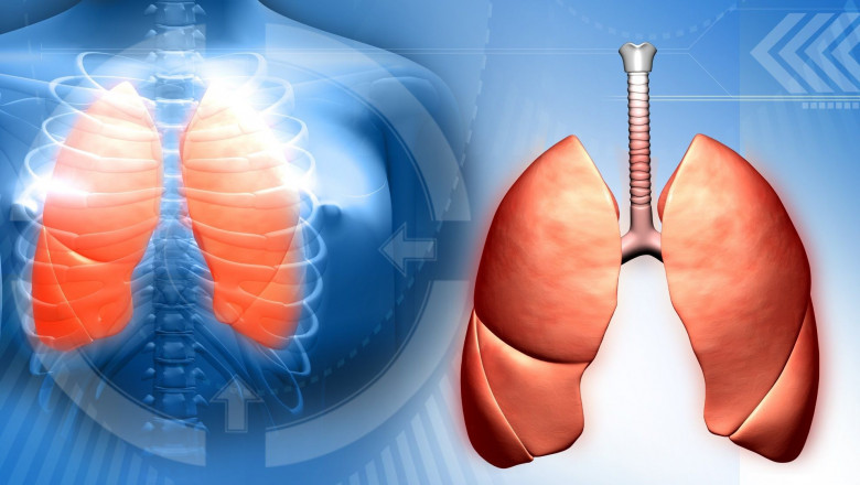 Bacterium - Unani Medicine Cause For Tuberculosis Infection?
