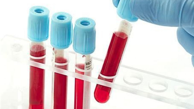 Blood Screening Market 2022 | Covid-19 Impact Analysis and Industry Forecast Report Till 2028