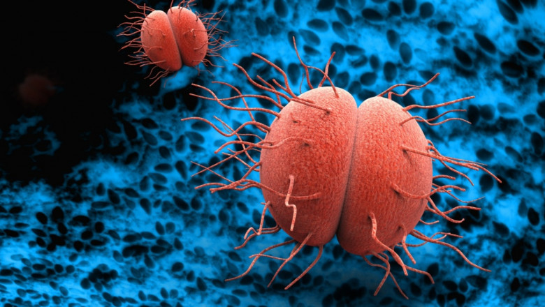 Diplococcal Bacterium - Best Herbal Medicine For Gonorrhea ?