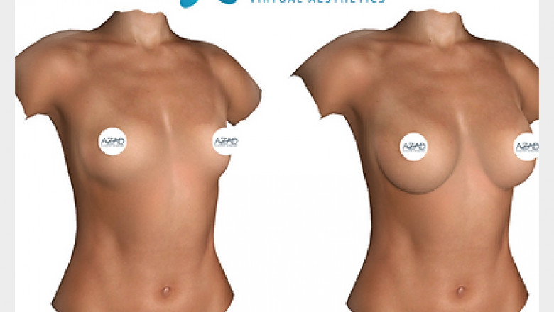 Love to see celebrity vision on your body, Mommy makeover Orlando Winter Florida