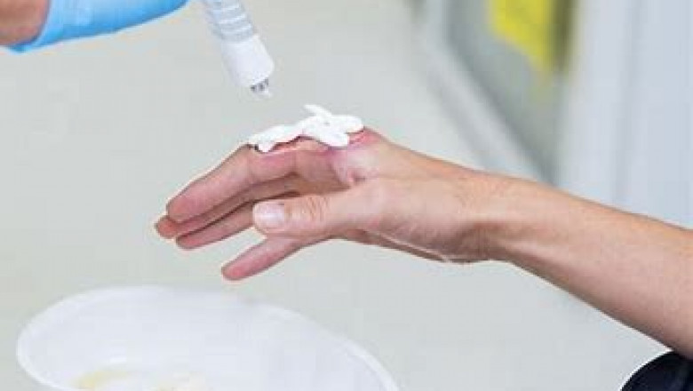 Burn Care Market 2022 - Leading Key Players are .................