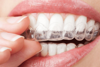 How To Maintain Dental Implants?
