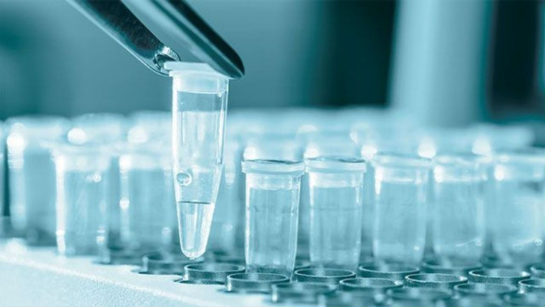 Global QPCR Market Report, Latest Trends, Industry Opportunity & Forecast to 2028