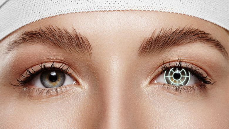 Loan for Laser Eye Treatment in Bhopal