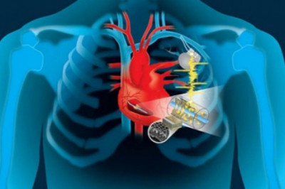Structural Heart Devices Market Research Report: Size & Share, Key Players, Growth Strategies till 2028