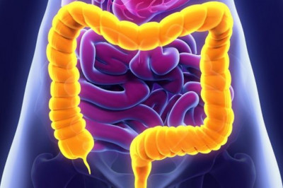 China Ulcerative Colitis Affects Both The Rectum And Colon's Inner Lining