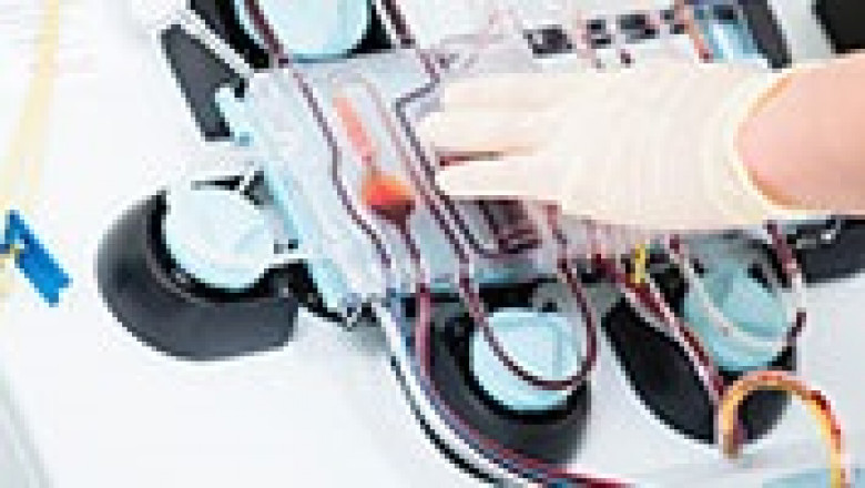 The Future and Growth For Continuous Renal Replacement Therapy (CRRT) Market