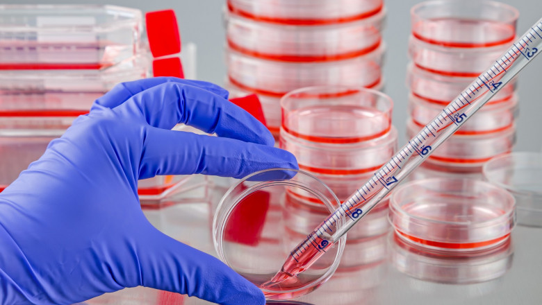 The Cell And Tissue Culture Supplies Are Essential To Analyze The Culture