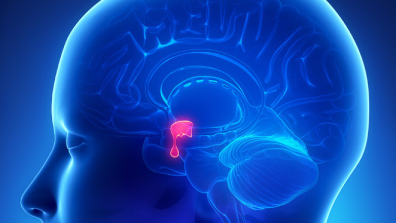 Trends, Share, Size, Growth, Opportunity and Forecast for the Global Acromegaly Treatment Market 2022-2028