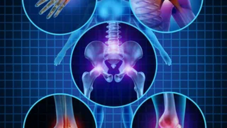 Arq E Ushba - Herbal Medicine For Joint Pain?