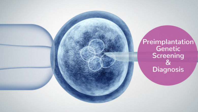 Best Pre implantation Genetic Diagnosis in Hyderabad