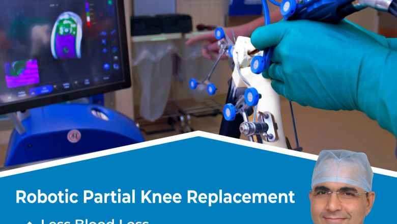 Partial Knee Replacement in Jaipur