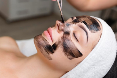 Carbon Peeling  In Delhi - Ayushmanscs