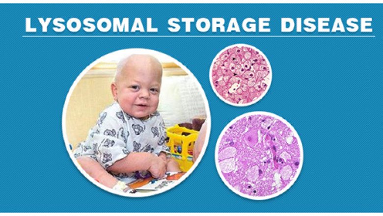 Lysosomal Disease Treatment Market Size, Key Players Analysis And Forecast To 2028 | Value Market Research
