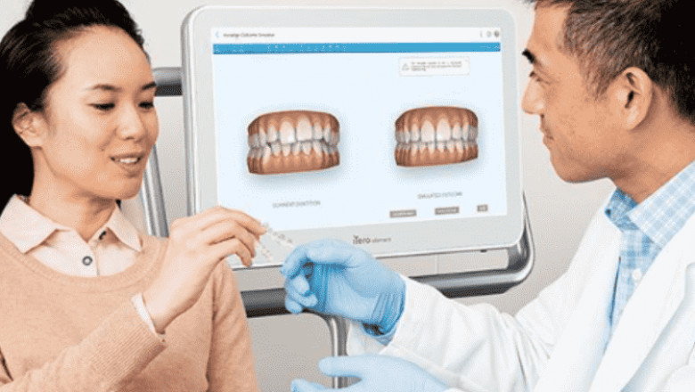 You are Just 4 Steps Away from Unlocking the Perfect Smile!