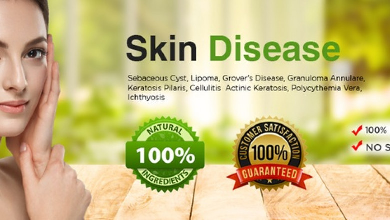 Herbal Skin Care Products - The Best Herbal Remedies for Skin Disease