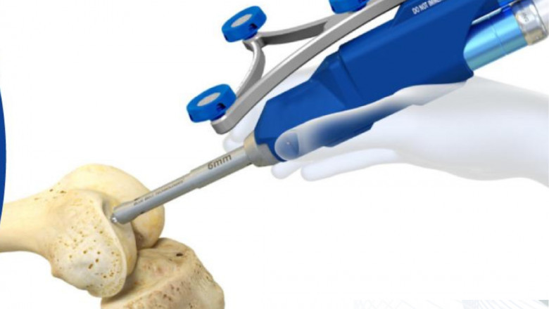 Best Knee Replacement Doctor in Jaipur
