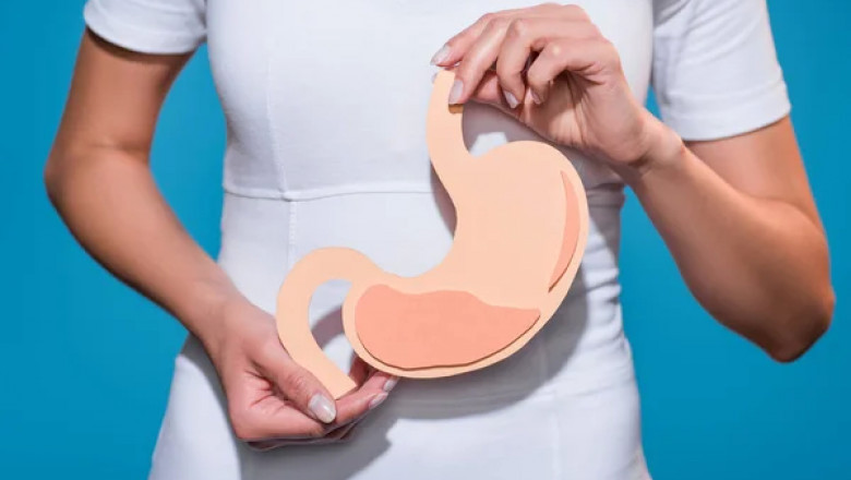 Gastroparesis Treatment Helps In Controlling The Diseases, Does Not Cure It Completely