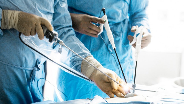 Hernia Repair Devices Are Often Recommended For Patients To Cure Obesity, Diarrhea, Constipation