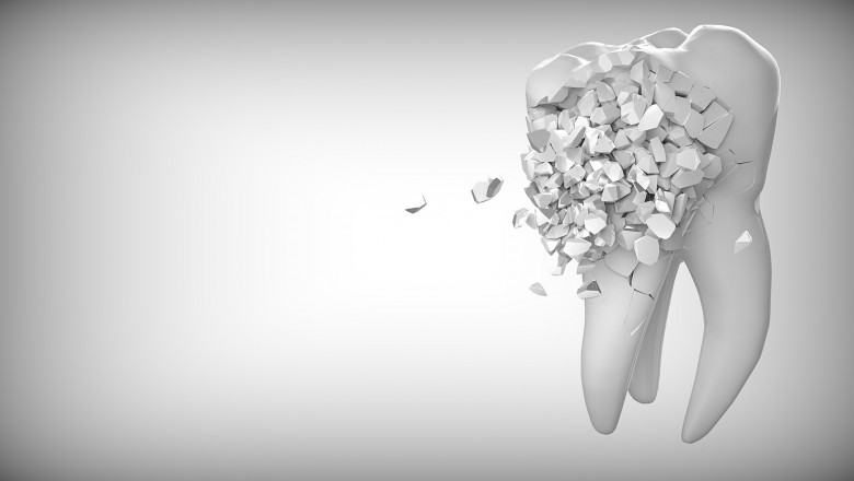 Eight Dental Care Guidelines for Children's Teeth in Good Health