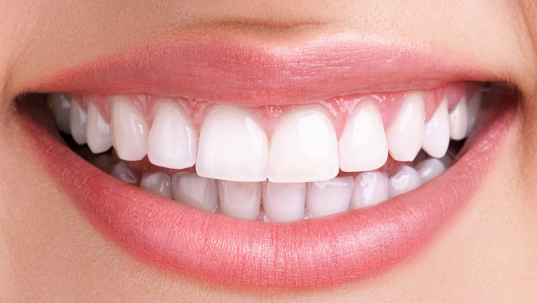 Smiles On 35th: Offering Quality Dental Services