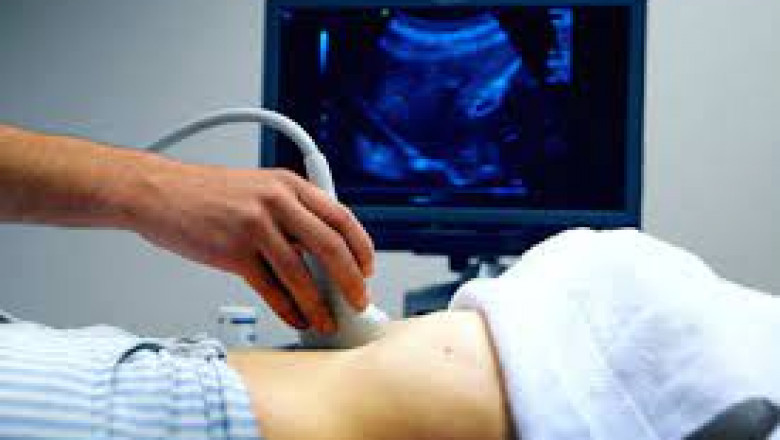 Ultrasound training course made easy with IOUT.