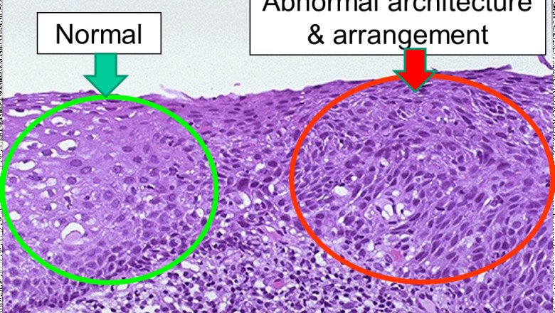 Global Cervical Dysplasia Market: Share, Size, Growth, Opportunity and Forecast 2020-2027