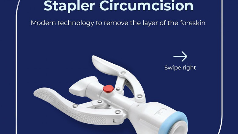 Safe And Proper Circumcision Services Kuala Lumpur – Opt For The Best