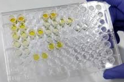 Global Alkaline Phosphatase Kits Market 2022 - Top Key Players Analysis Report Till 2028