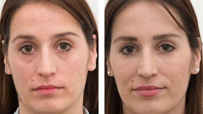 Skin care: 5 tips for healthy skin