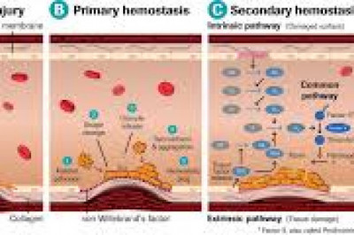 Thrombophilia Testing Market Size, In-depth Analysis Report and Global Forecast to 2028