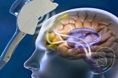 Transcranial Electrical Stimulators Market Competitive Landscape and its Industry Growth Prospect By 2028