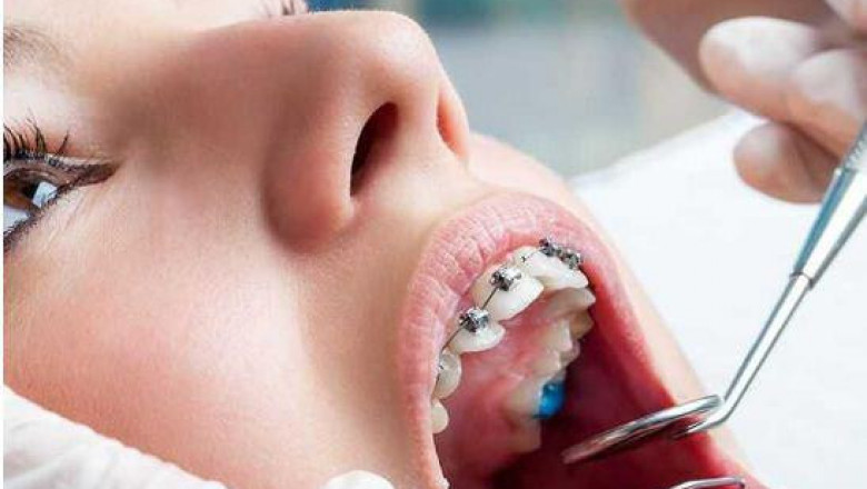 Warning Signs That You Need Emergency Dental Care: