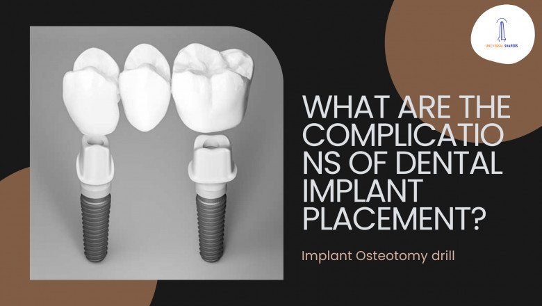What Are the Complications of Dental Implant Placement?