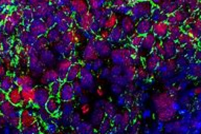 Whole Exome Sequencing Market Analysis | Recent COVID-19 Impact and Industry Trends Report, 2028