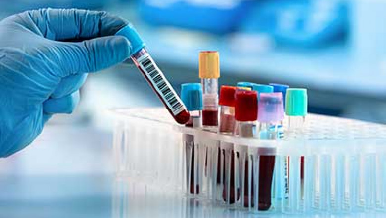U.S. Esoteric Testing Market Share, Regional Growth and Outlook by 2030