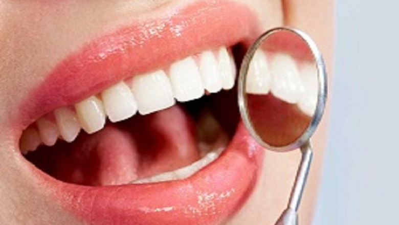 What Happens When You Get a Root Canal on Your Front Teeth?