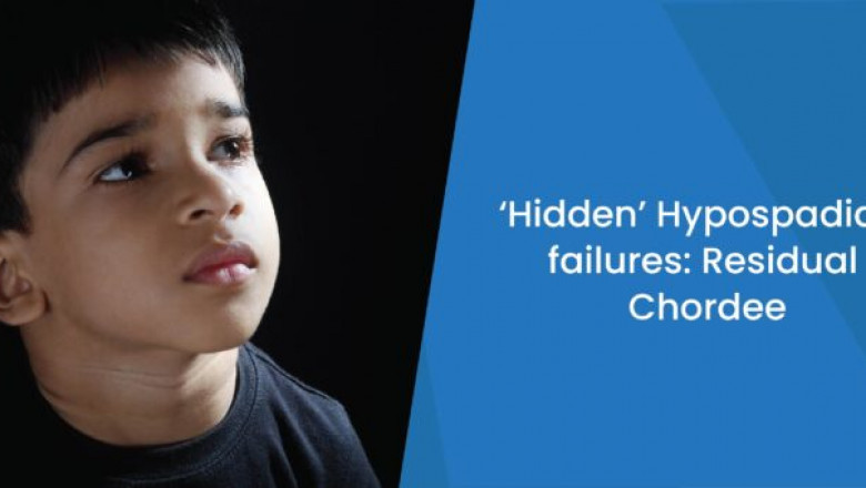 ‘Hidden’ Hypospadias Failures: Residual Chordee