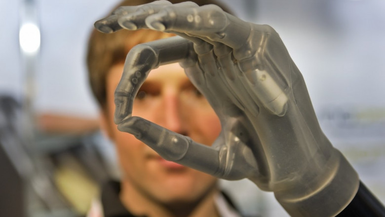 Medical Bionic Implants Perform Similar Functions to Natural Human Organs