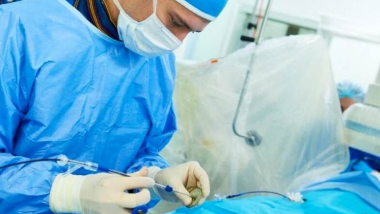 Permcath Insertion or Tunneled Catheter Insertion