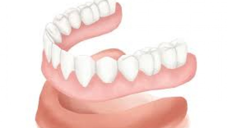 Global Denture Market Report, Latest Trends, Industry Opportunity & Forecast to 2028