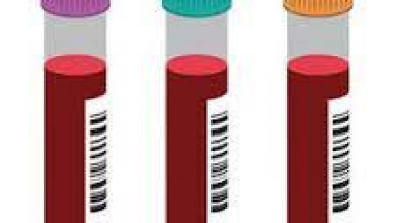 Blood Collection Tubes Market 2022 Size, Dynamics & Forecast Report to 2028
